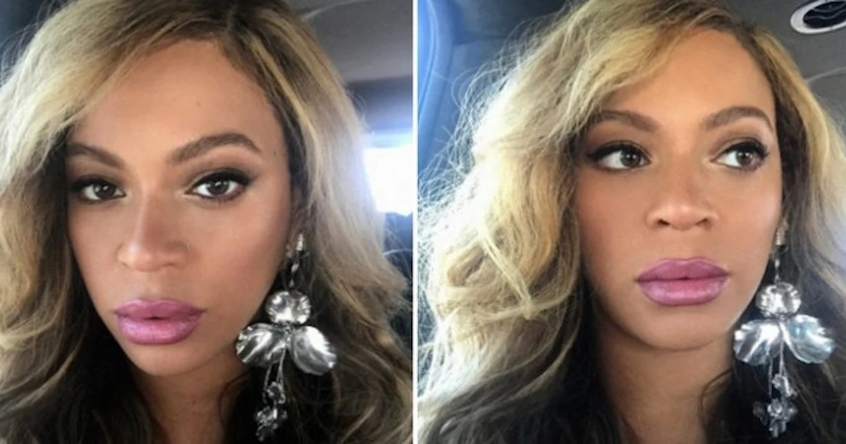 Beyoncé Fans Think She Got Lip Injections After Recent Pics