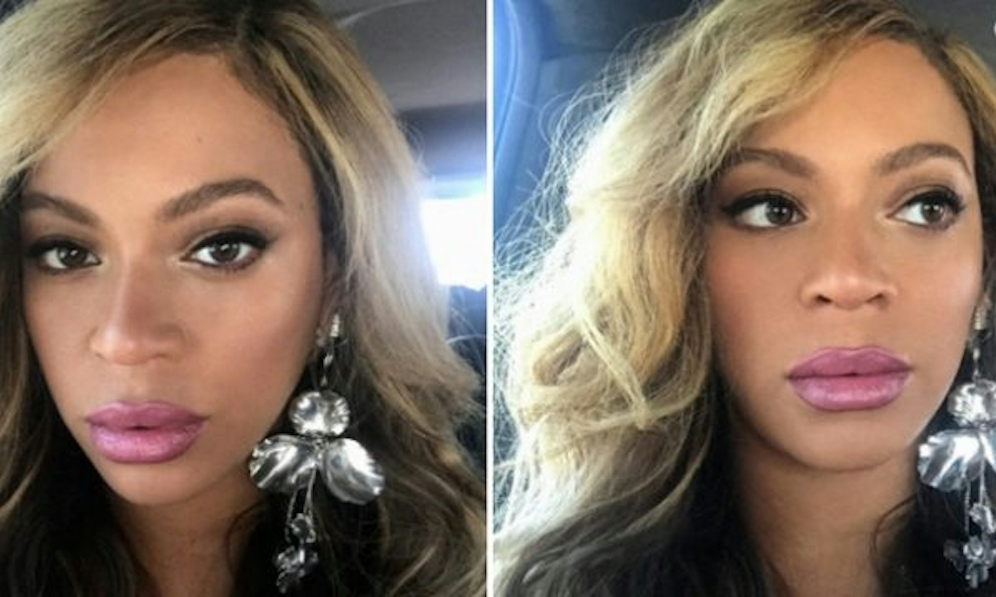 Beyoncé Fans Think She Got Lip Injections After Recent Pics