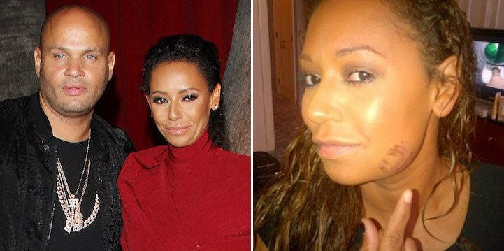 Spice Girls' Mel B On Stephen Belafonte's Abuse