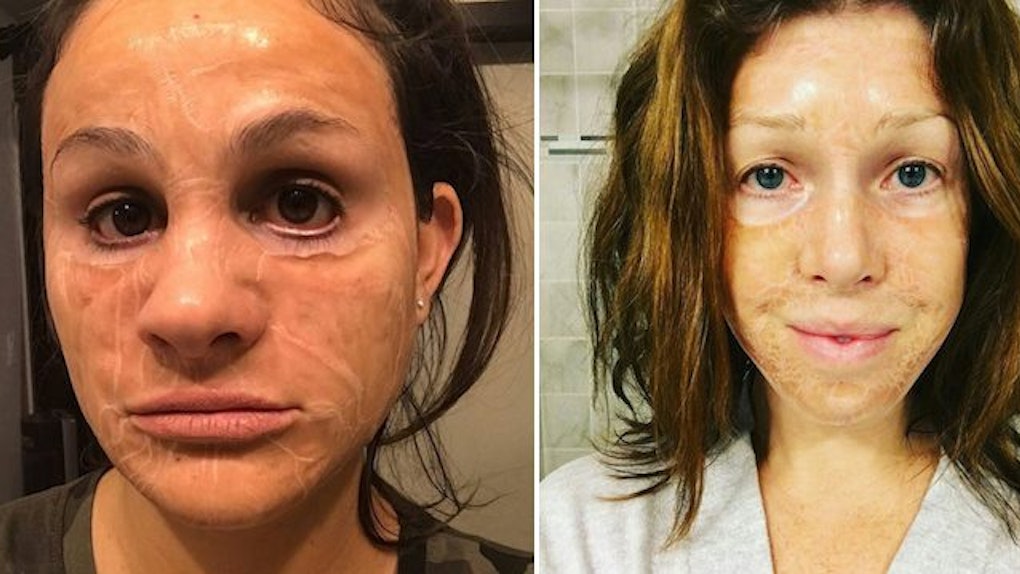 Korean hanacure Korean hanacure