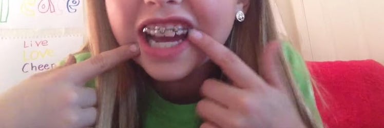 diy braces
