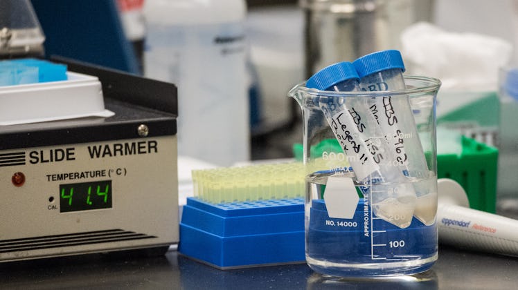 Frozen Sperm Helps Prevent Spread Of Zika