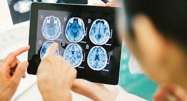 scientists study brain injury