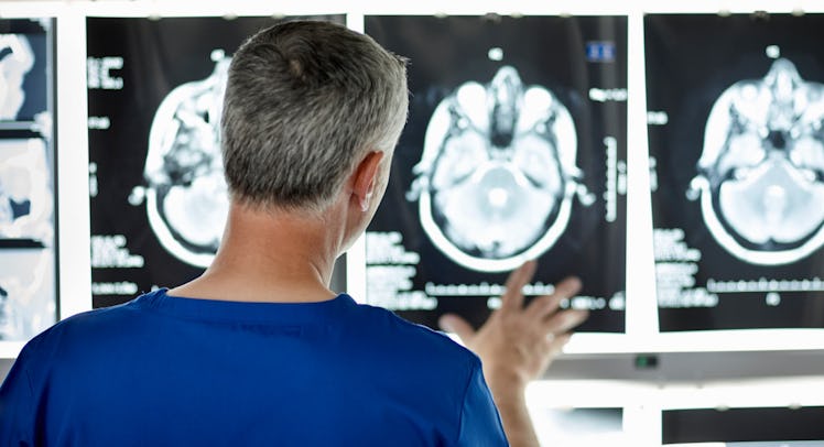 radiologist looking at brain scans