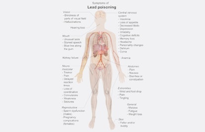 symptoms of lead poisoning