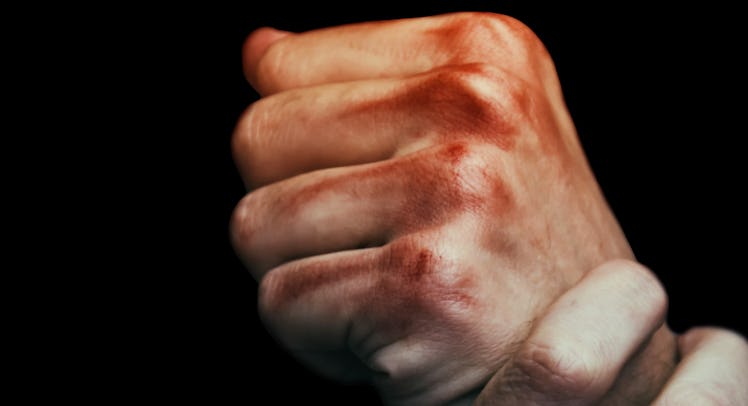 bruised knuckles