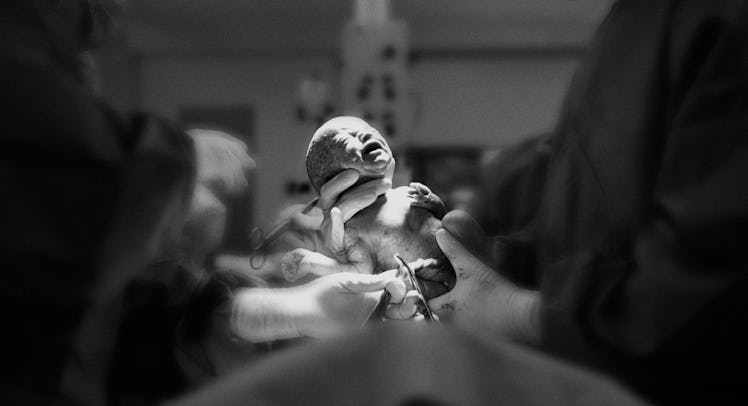 A newborn baby being held by a doctor in the hospital after delivery.