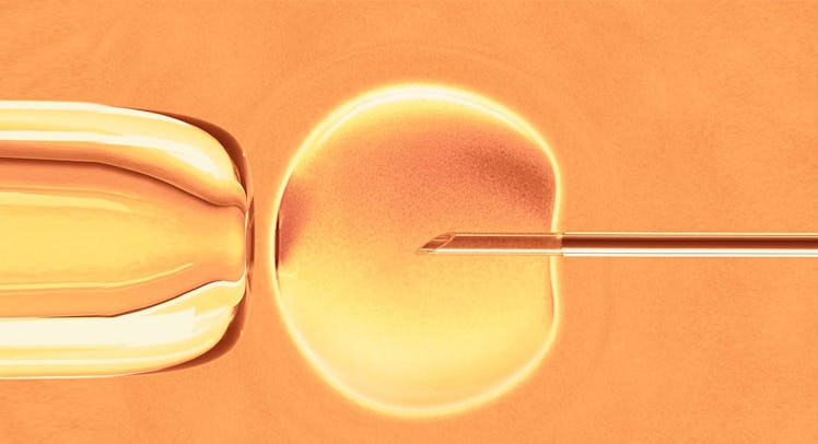 An illustration of the In-Vitro Fertilization process