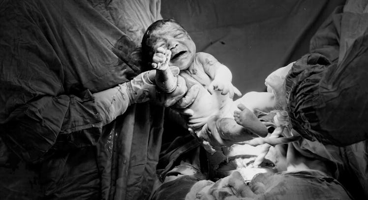 A mother giving a birth by Cesarean Sections