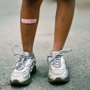 A child's legs, with a bandage on their knee.