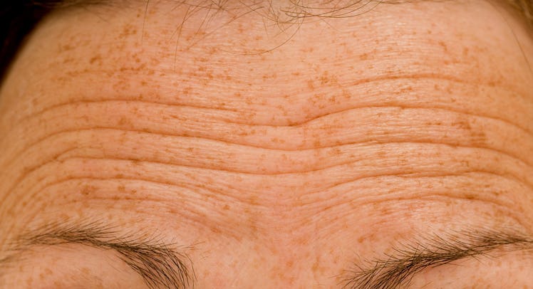 A man's forehead wrinkles.