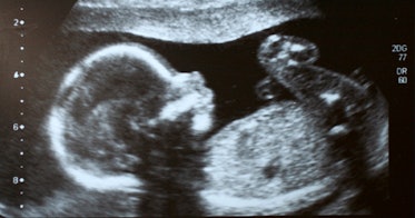 超音波的婴儿在子宫里。
