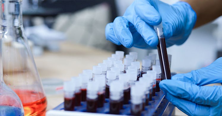 Gloved hands test vials of dark blood