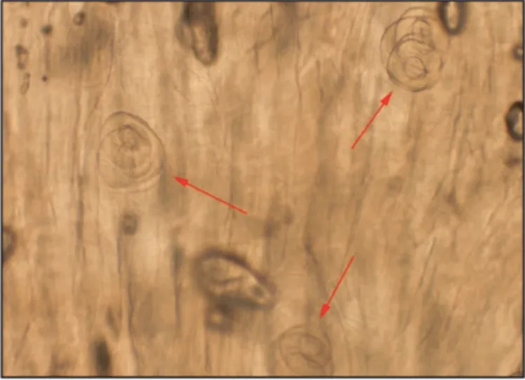 Meat Cyst Parasite in California Boar Meat Literally Makes Your Eyes Bleed