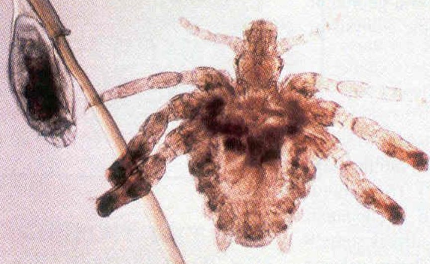 Principal 143+ imagen crabs from toilet seat In.thptnganamst.edu.vn