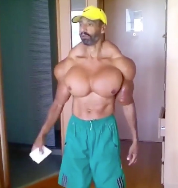 Synthol. Not even once. : r/WTF