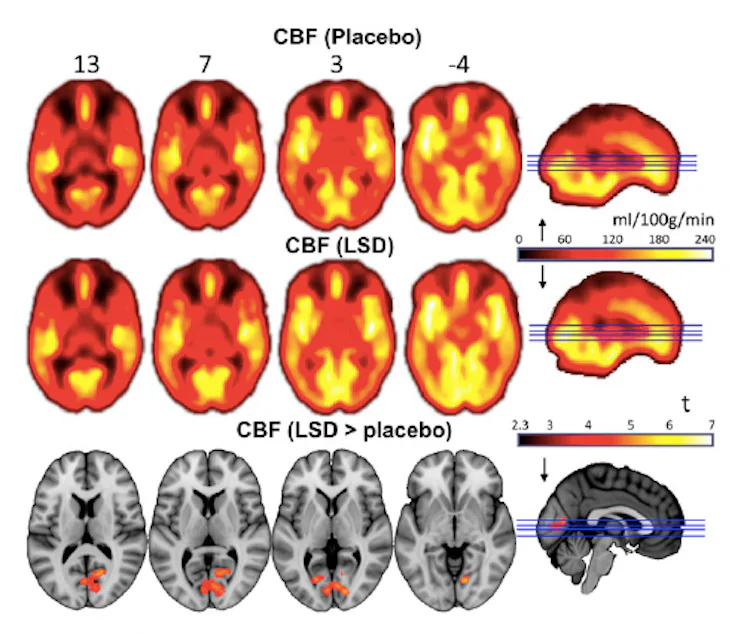 Lsd Perception Distortion Example New Brain Images Show How LSD Affects Our Minds