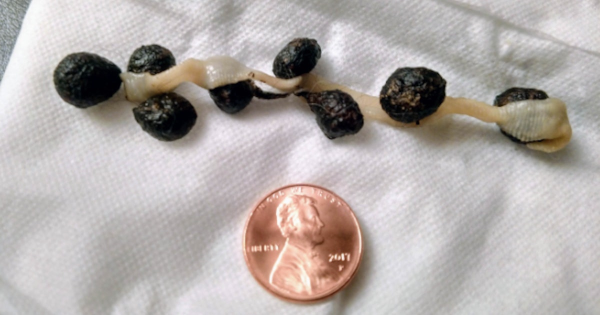 What Does Rabbit Poop Look Like at Thomas Nickell blog