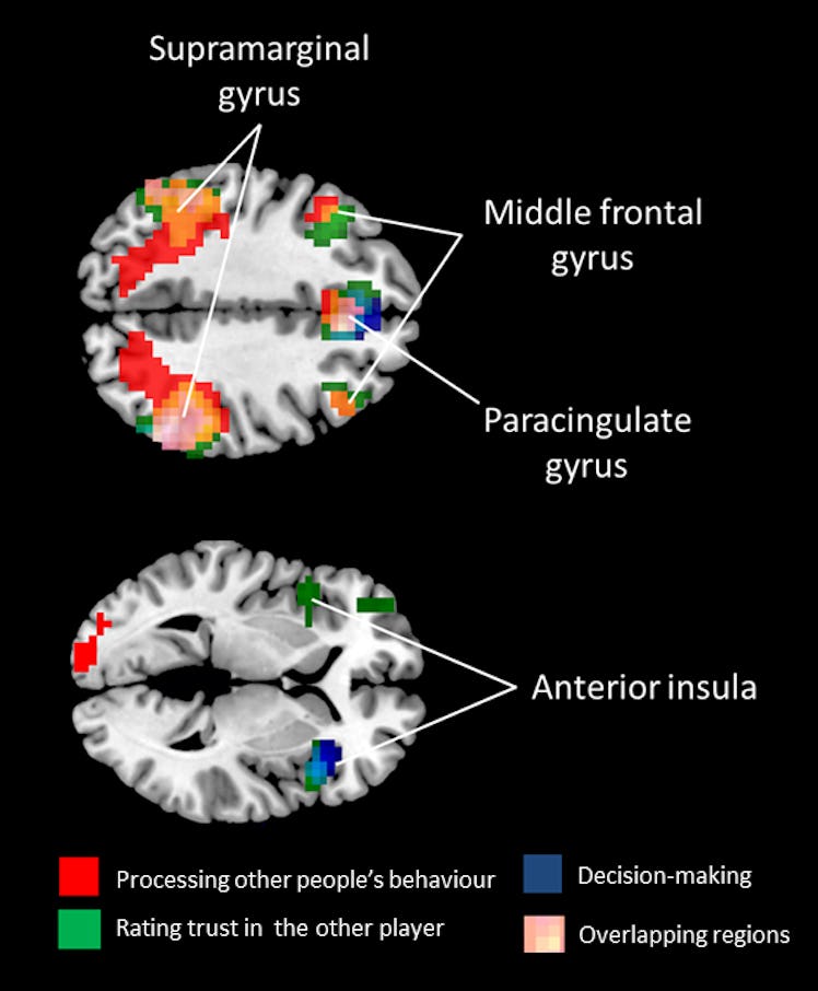 MDMA brain