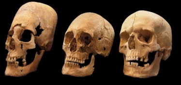 Researchers suspect elongated skulls (left) found in modern-day Germany belonged to southeastern Eur...