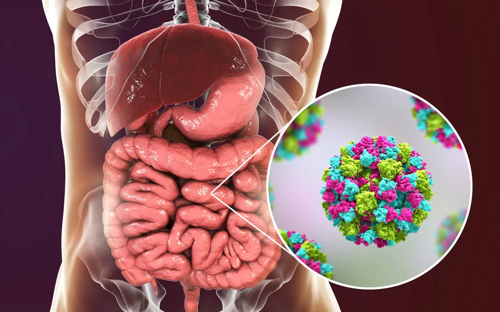 Blood type may be the reason why only some get norovirus — study