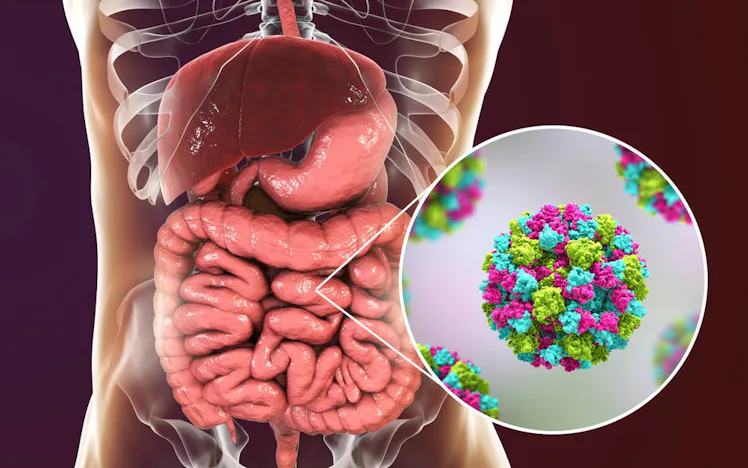 Blood type may be the reason why only some get norovirus — study