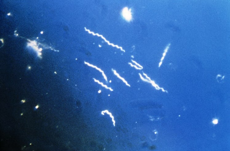 Borrelia burgdorferi