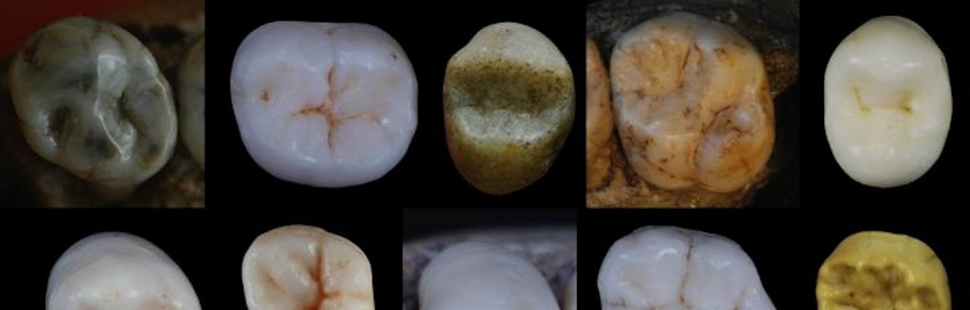 Bussel Teeth Ancient Teeth Reveal the Ancestor Humans Likely Share With Neanderthals