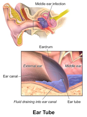 ear tube diagram