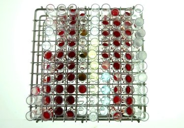 blood test tubes rack laboratory samples