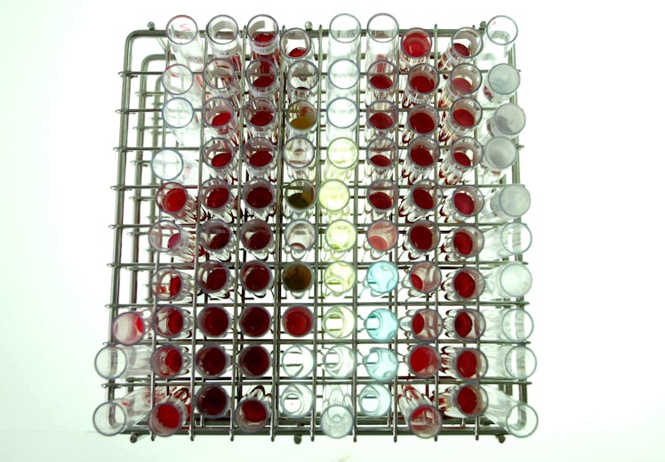 blood test tubes rack laboratory samples