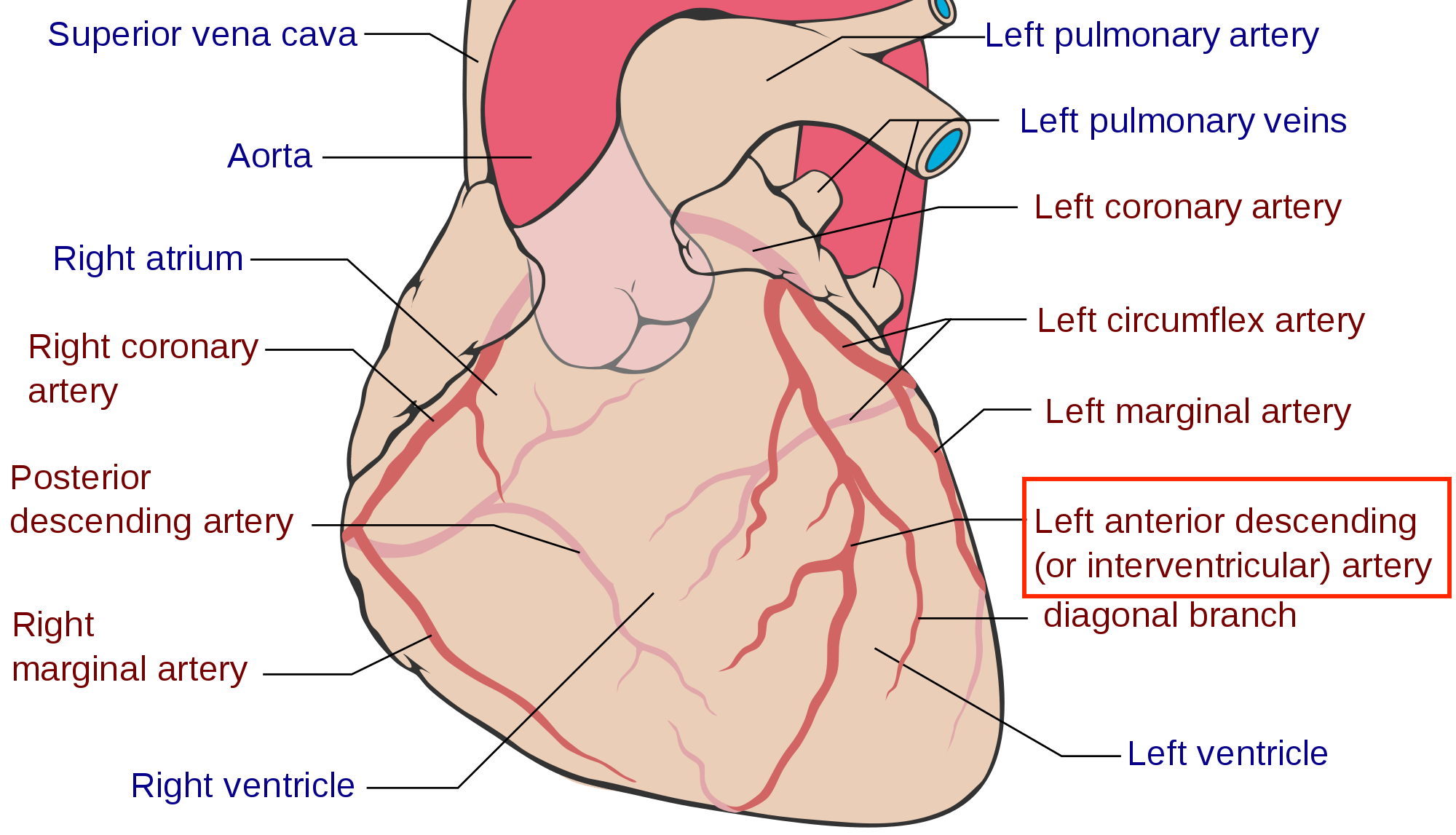 What is a Widow-Maker? Kevin Smith's Scary Symptoms Land Him in the ER