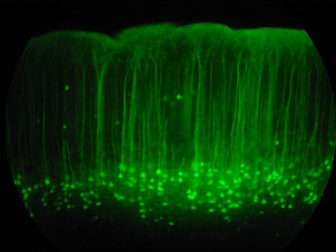 Edit: Hurray for the GFP Nobel Prize. Aside from just green, it is a wonderful rainbow of tools prov...