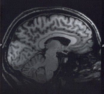 fMRI of 'me'