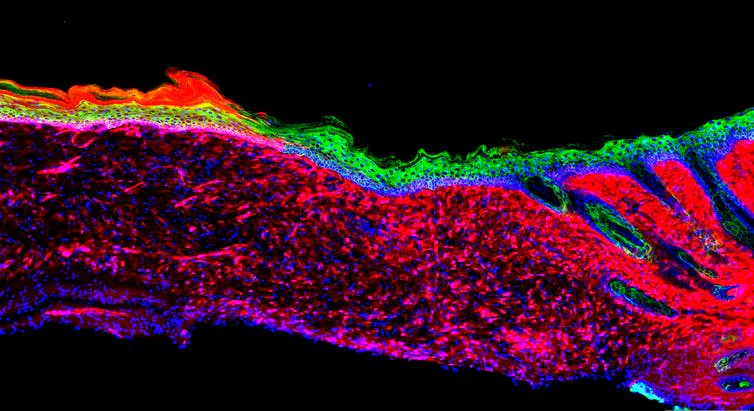 This Stem-Cell-Based Approach Will Regenerate Wounds Into Healthy Skin