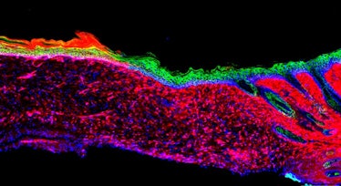 This image is a cross-section of regenerated skin with different cell types indicated with fluoresce...