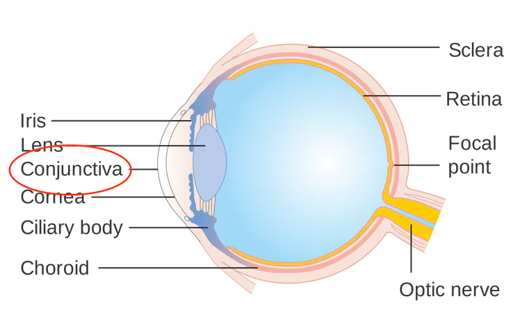 NBA Finals: Why Is LeBron James’s Eye Still Red After Game 2?