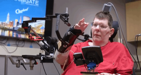 Brain Implants Allow a Quadriplegic to Move Arm Just by Thinking
