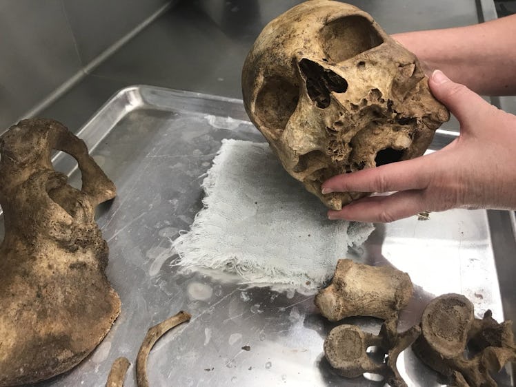 Dawnie Steadman, director of the Forensic Anthropology Center, examines a skull from the University ...