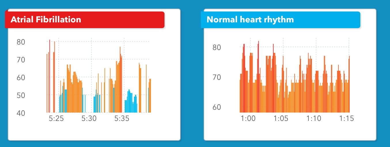 Heart rate versus heart rhythm