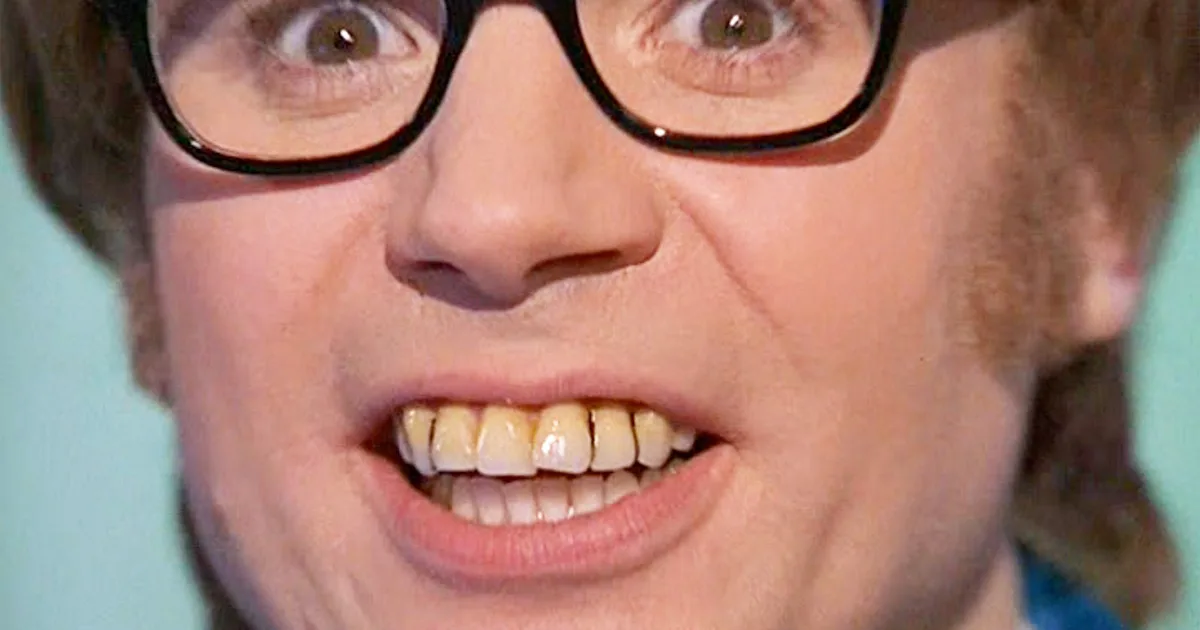 Bussel Teeth Americans Have Worse and Fewer Teeth Than British People