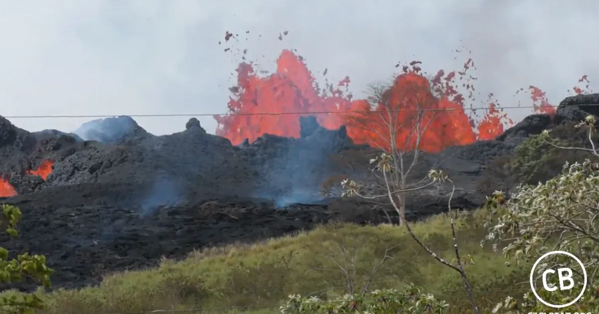 Volcano Injury Kilauea Volcano: First Human Injury Caused by Projectile Lava Spatter