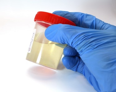 THC can be detected in your urine for up to two months in some cases.