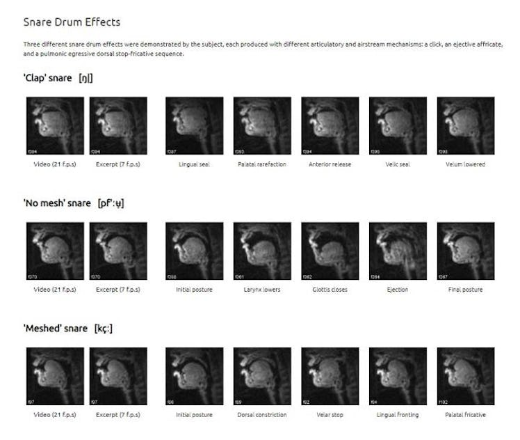 vocal tract MRI comparison