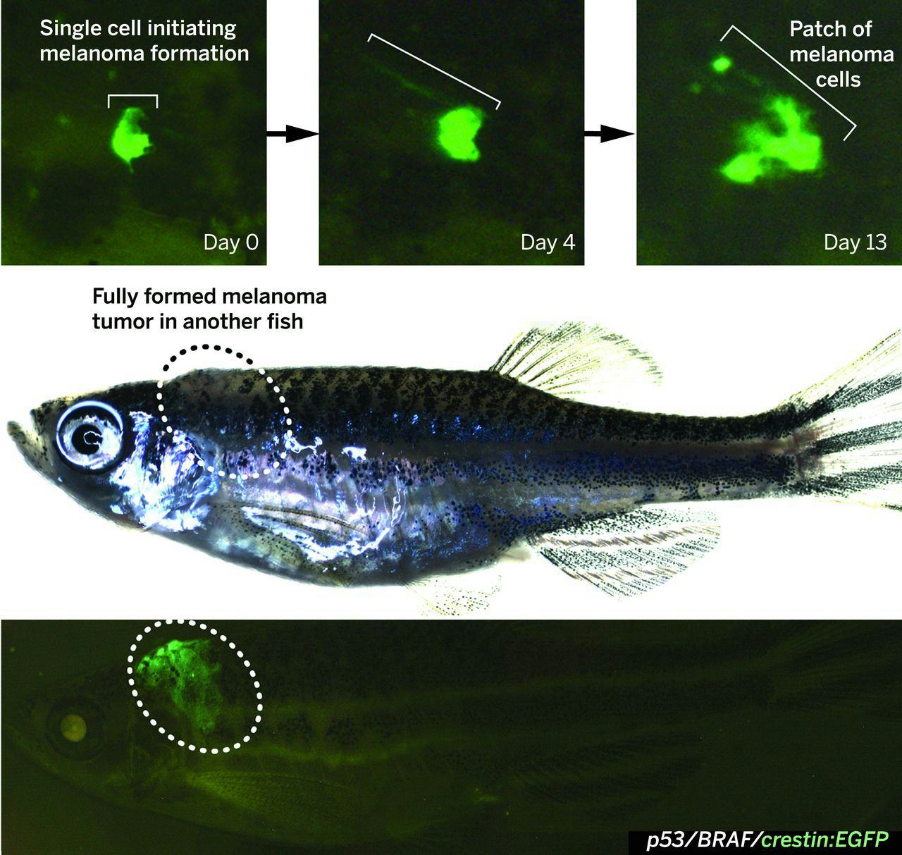 Zebrafish Melanoma Study Reveals Cancer's Mysterious Origins