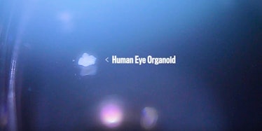 organoid