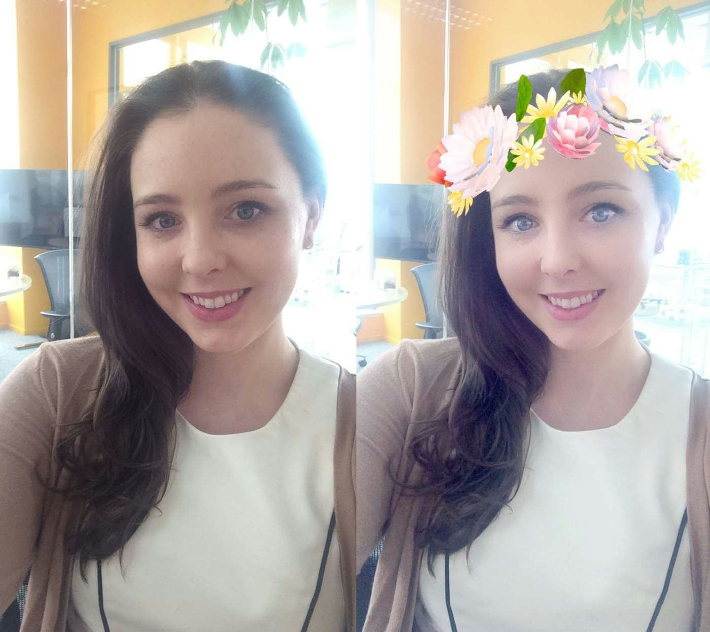 Plastic Surgeons Are Worried About a Condition Called "Snapchat Dysmorphia"