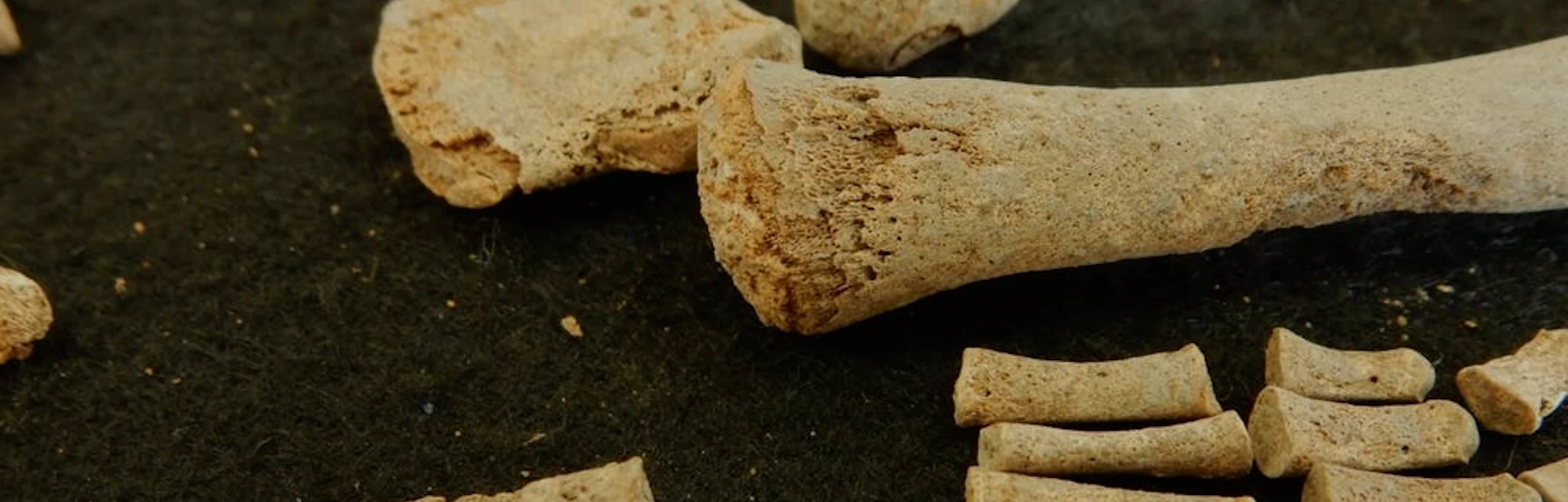 Oldest-Ever Syphilis DNA Sequenced From Convent Cemetery Skeletons