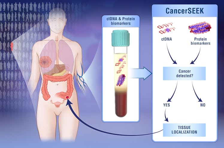 Doctors have developed a noninvasive blood test for eight types of cancer.