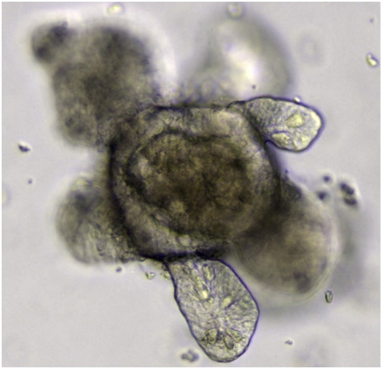  Intestinal organoid grown from Lgr5+ stem cells. St Johnston D (2015) The Renaissance of Developmen...